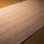 Close-up of an ECG printout depicting heart activity, placed on a wooden surface.